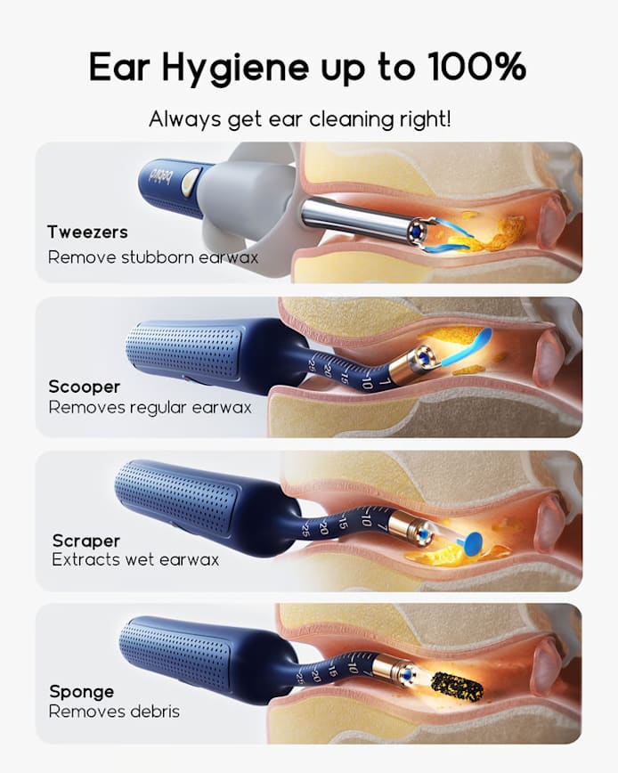 Smart Ear Kit – Safe & Effective